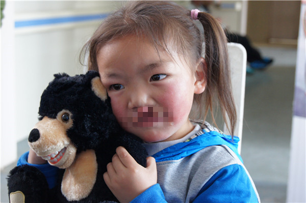 1520932207655976.jpg 楊元波(男)術前照 (2014)(嘴部馬賽克).jpg